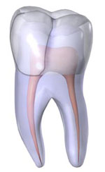 image of a cracked tooth front view 
