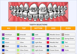 braces color selector