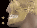 Animated Mandibular Dental Protrusion teeth
