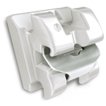 Animated close-up of an In-Ovation® system braces bracket