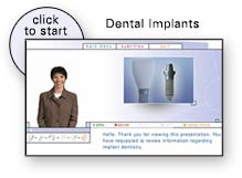 dental implant presentation