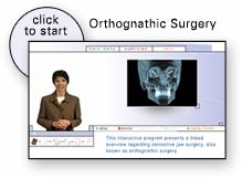 Presentación de cirugía ortognática