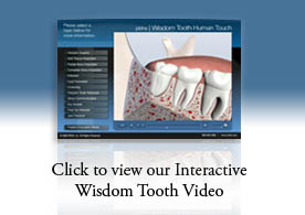 Wisdom Teeth Presentation